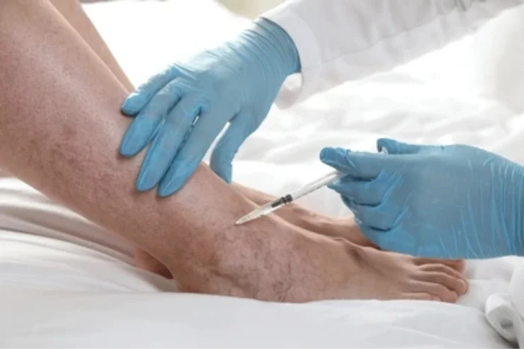 Vascular and Varicose Vein Treatments